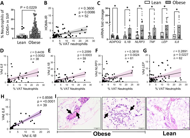 Figure 1. Obesity-associated microbiomes instigate visceral adipose tissue inflammation by recruitment of distinct neutrophils